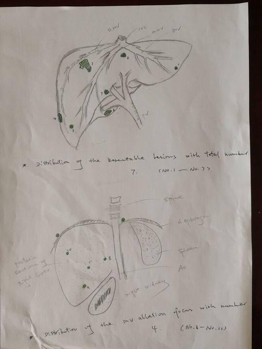 最新病情分部的高科技產(chǎn)品介紹概覽