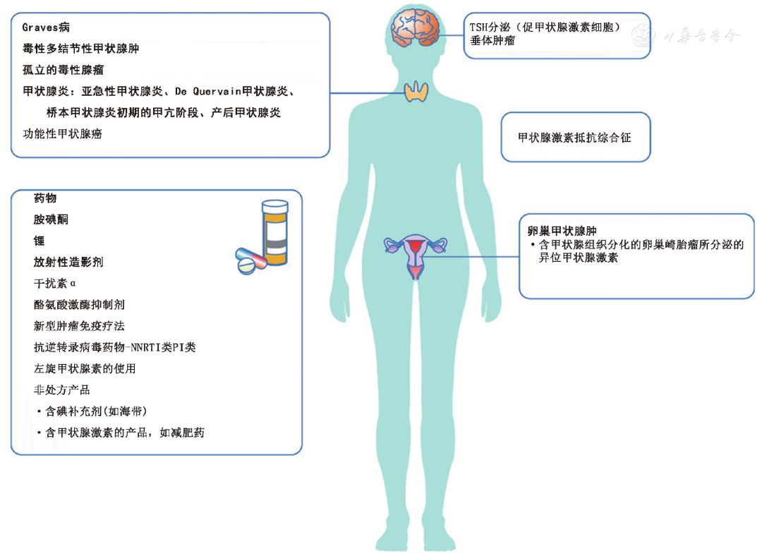 甲狀腺功能亢進(jìn)癥最新研究進(jìn)展,甲狀腺功能亢進(jìn)癥最新研究進(jìn)展