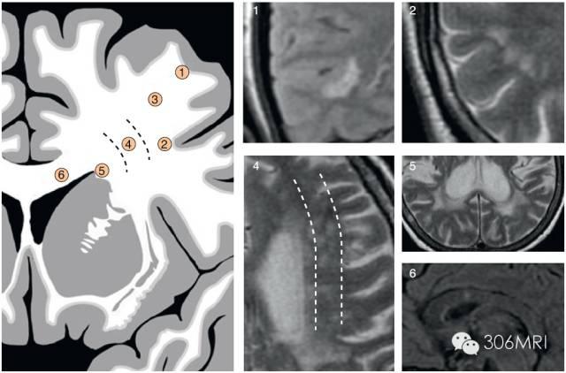 u影魅力新網(wǎng)址，探索影視娛樂(lè)的新世界